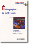 Échographie de la thyroïde (Coll. Imagerie médicale : formation)